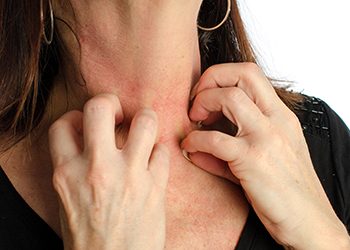 turmeric may be helpful for skin conditions such as radiation dermatitis